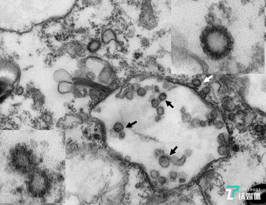 从穿山甲组织中提取的新型冠状病毒电镜照片（来源：华农方面）